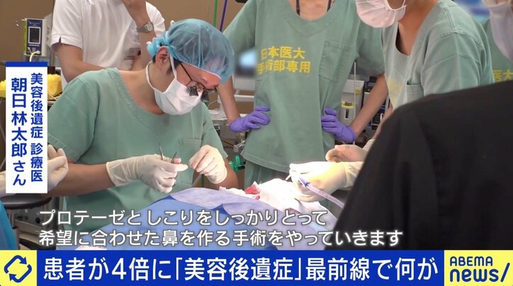 「口元の感覚がなくなって…」美容整形後のリスク “後遺症”患者増加に医師が警鐘
