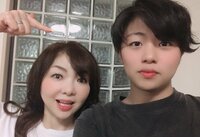 ハイヒールモモコ『ギプス取れました!』