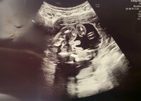 桃『ついに赤ちゃんの性別が発覚！！！！！』