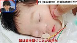事故で妊婦死亡、赤ちゃんは重い障害…「胎児も被害者」遺族が訴え 亡くなった妻がとっさに守った命