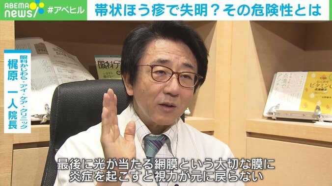 帯状疱疹で失明？ 疲れとストレスがトリガーに 3枚目