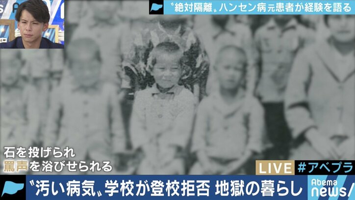 「二度と学校に来るな」と教師に言われた小6の夏から70年…差別や偏見と闘い続けてきたハンセン病回復者の半生