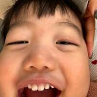 桃『先天性眼瞼下垂症の手術から2ヶ月半!』