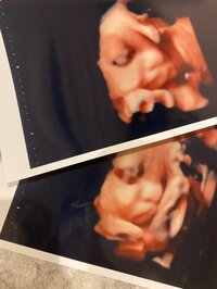 くみっきー『エコー写真』