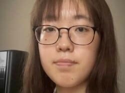 いじめが原因で整形決意…24歳整形依存美女、整形前の写真を公開「お母さんじゃなくて！？」驚きの声