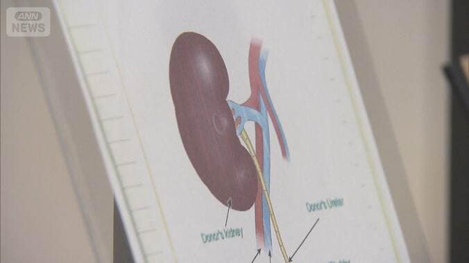 保釈中にも“臓器移植”斡旋か　背景に深刻な「ドナー不足」 1枚目
