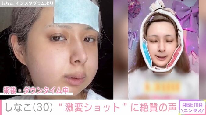 “両あごの骨切り手術を公表”しなこ（30）、激変ショットに「だ だれ!?」「SOPHIAの松岡さんかと思った」と絶賛の声 4枚目