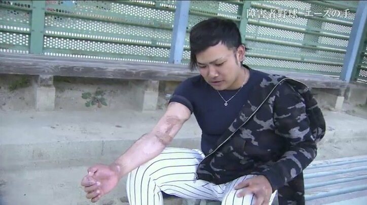 「この手だから、ここまで努力できた」“唯一無二”のグラブで新たな可能性を切り拓く障害者野球界のエース