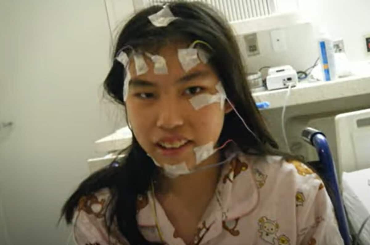 脊髄 小脳 変性 症 有名人