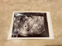 内山琴『妊娠してから①初めてのエコー』