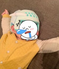 しゃん『ヘルメット矯正卒業①』