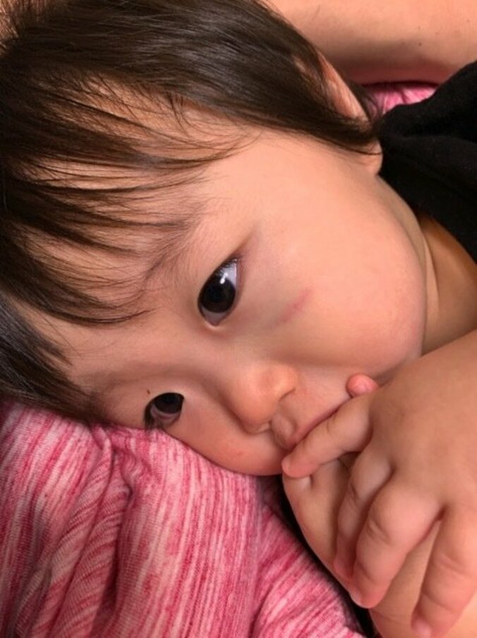 浜田ブリトニー、娘が顔にケガをしたことを報告「保育園が楽しすぎて　はしゃいじゃったんだね」 1枚目