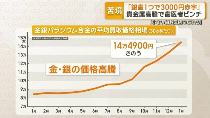 金銀パラジウム合金の平均買取価格相場（30gあたり）