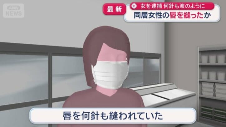 唇を何針も縫われていた