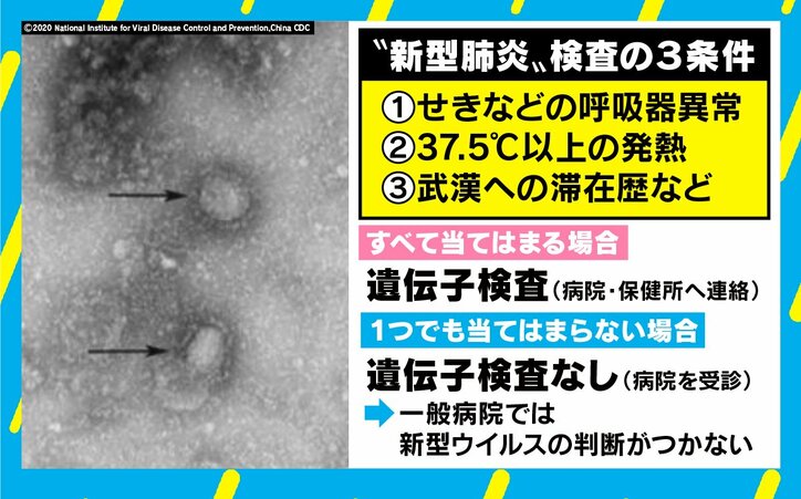 “新型肺炎”対策や予防について専門家が解説 封じ込めは「無症状の感染者がいるため困難」