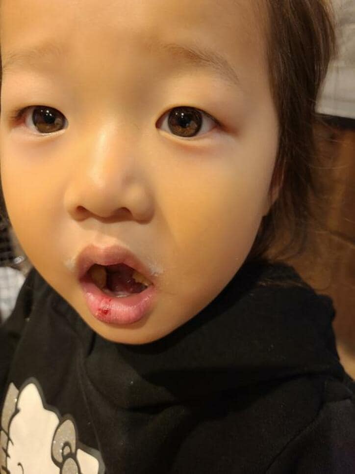  小原正子、娘が唇に怪我を負ったことを告白「おうちで遊んでいるときに」 
