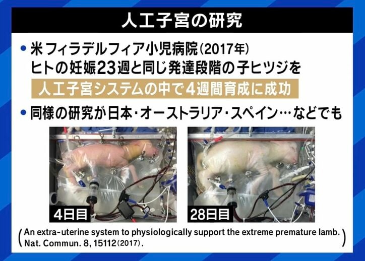 【写真・画像】早産児の救命を 「人工子宮」研究に期待の声、一方で生命倫理の問題も 「“重症の新生児にもっと良い治療はないか？”という医療現場の願いから始まった研究だ」　2枚目