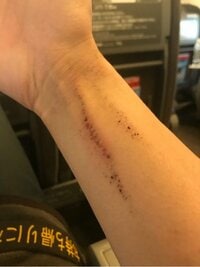 狩野英孝『アトピー』