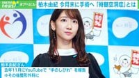 "アイドルと休養"AKB48柏木由紀さん手術へ