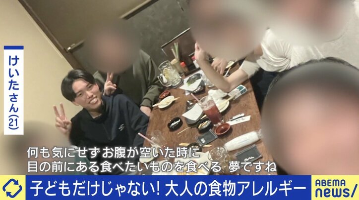 大人の食物アレルギー