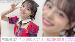 “1万5000人に1人” 弟の難病を告白 NGT48本間日陽「つらいことずっとありました」