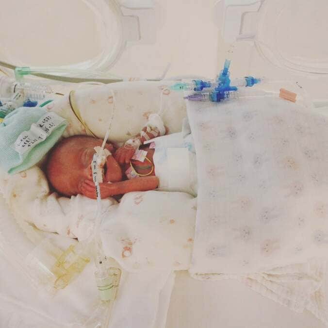 写真家の田尾沙織さん、500gで出産しほとんど大きくならなかったお腹「私の見た目もほぼ変わらず」  1枚目