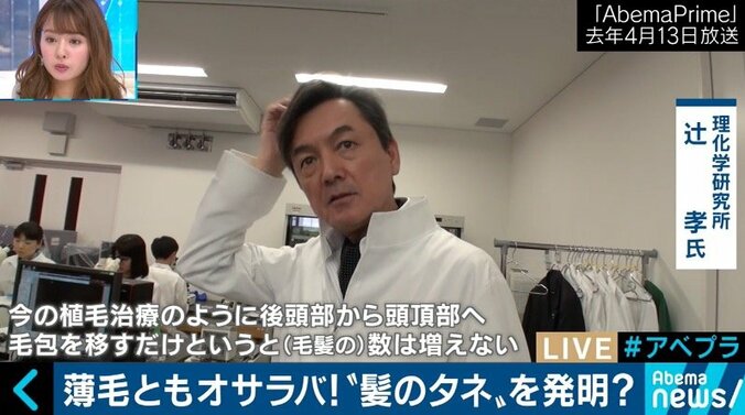2020年には薄毛治療に革新？日本の再生医療技術がついに“髪のタネ”を発明 5枚目