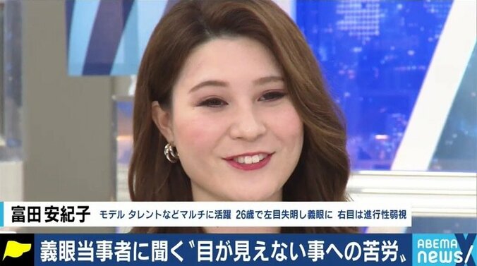 「義眼で人生が変わった」「片目が見えるじゃないかと言われ、障害者として認めてもらえない」…当事者たちに聞いた「片目失明」のリアル 8枚目