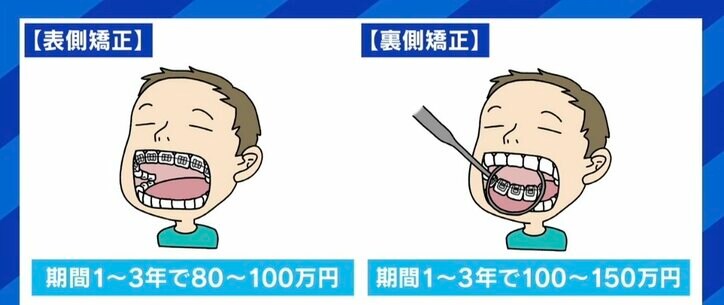 高額報酬で実質無料を謳う歯科矯正が裁判トラブルに 歯科医師「バカにされた。許せない」「医療から美容に足を踏み入れている」