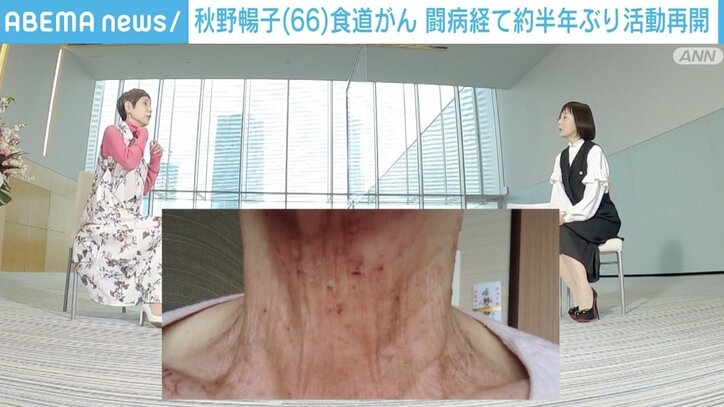 「のどの中に剣山があるような」 秋野暢子さんが約半年ぶりに活動再開 食道がん闘病、放射線治療の激痛でも前を向く“強さ”