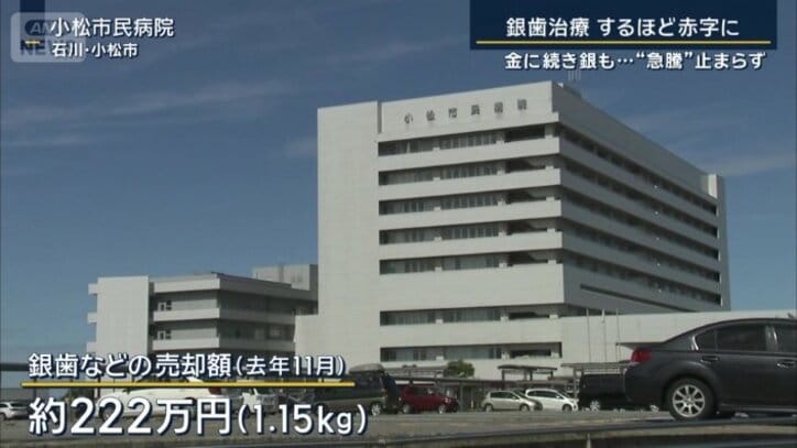 銀歯などの売却額