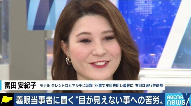 義眼で人生が変わった 片目が見えるじゃないかと言われ 障害者として認めてもらえない 当事者たちに聞いた 片目失明 のリアル 国内 Abema Times