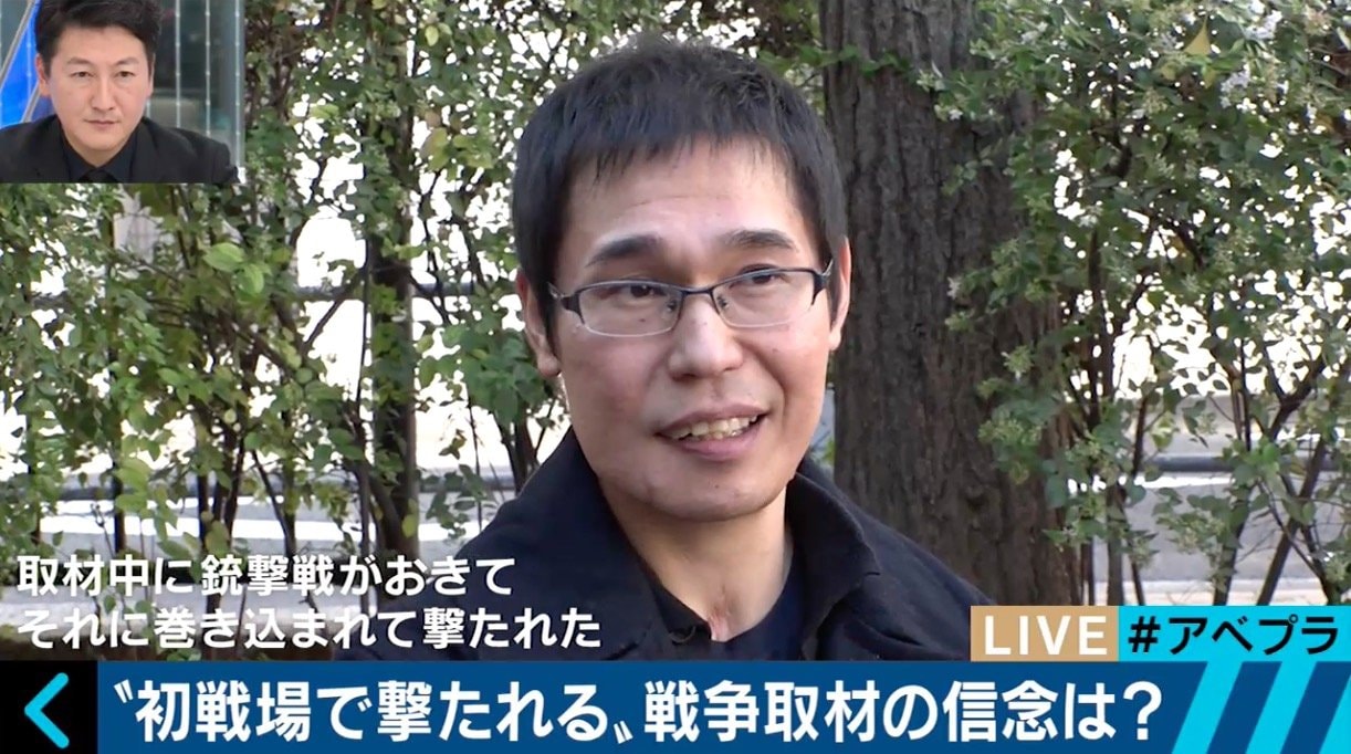 下顎を吹き飛ばされても取材をやめない日本人ジャーナリスト 国際 Abema Times 下顎を吹き飛ばされても取材をやめない日本人ジャーナリスト 国際 Abema Times