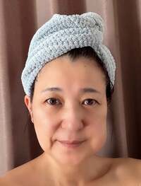 新田恵利『腫れてます(^◇^;)』