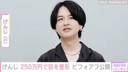 ファッション系YouTuberげんじ、250万円で目を整形しビフォーアフター公開「めちゃめちゃ綺麗」の声