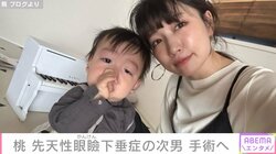 あいのり桃、先天性眼瞼下垂症の次男・じろくんの手術を決断「悩んでいる方に少しでも情報や選択肢を提供できれば」