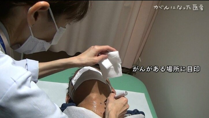 「“なったことないでしょ”って言われたら“おっしゃる通り”としか言えなかったので…」がんに罹った専門医の1年