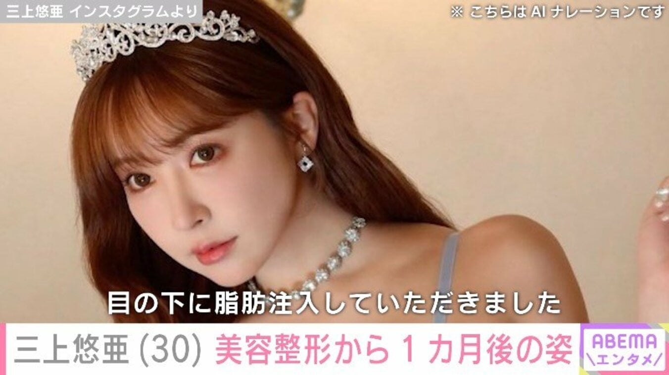 【写真・画像】三上悠亜の美容整形から1カ月後の姿に反響続々 「ますます可愛い」「憧れの女の子」 1枚目 | エンタメ総合 | ABEMA ...