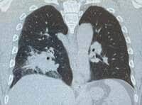 サンドウィッチマン富澤『ご心配おかけしました』