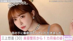 三上悠亜の美容整形から1カ月後の姿に反響続々 「ますます可愛い」「憧れの女の子」