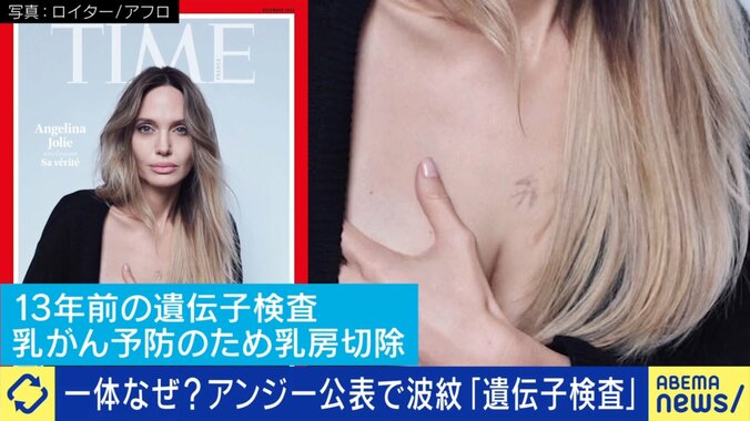 アンジェリーナ・ジョリー“乳房切除”の傷跡