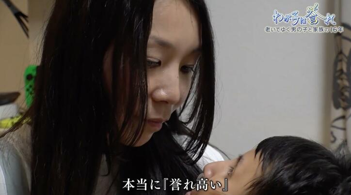 【写真・画像】5倍の速さで老化が進む「コケイン症候群」を抱える男の子 余命１年…家族の決断は 「わが子は誉れ」懸命に生きた16年の記録　10枚目