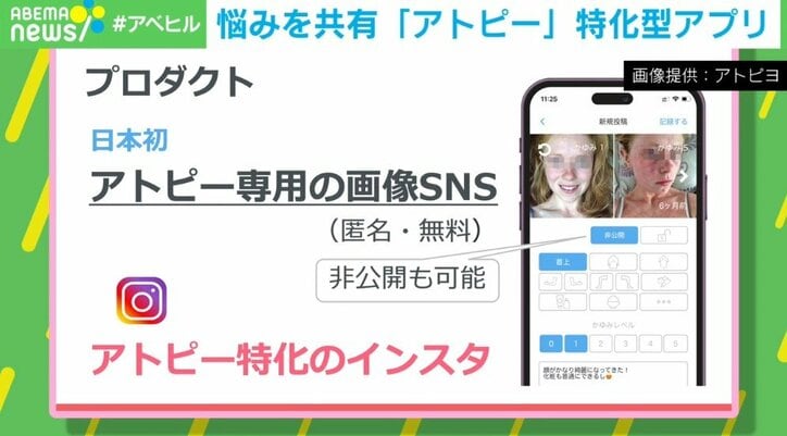 日本初、アトピー専用の匿名SNSアプリ なぜ、“悩み”も共有？開発者の思い「患者さん同士で励まし合うこともできる」
