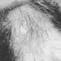 「一瞬、森の雪景色かと思った」ブラマヨ小杉の頭部ドアップ動画にファン混乱