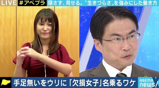 事故で右足ひざ下切断のこみみさん「何も提供してくれない第三者が『不謹慎』と言ってくる筋合いはないと思う」 障害を売りに働くことの是非 6枚目