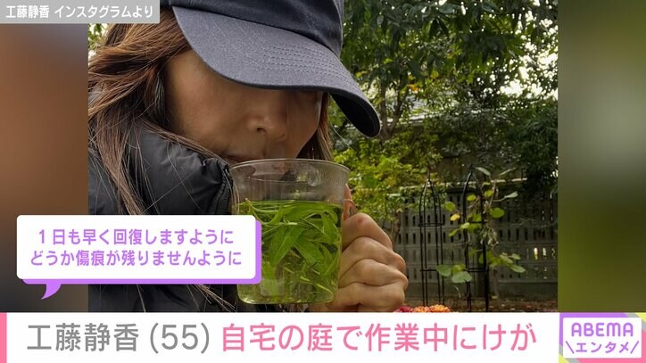【写真・画像】工藤静香（55）“すんごい豪邸”と話題 自宅の庭でけが「1日も早く回復しますように」など心配の声　2枚目