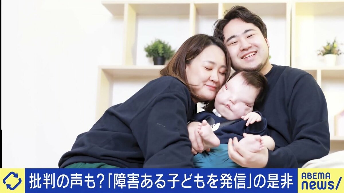 写真・画像】顔・頭蓋骨に形成異常を持つ息子を発信する両親の