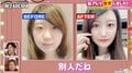 1500万円で“別人”となった美女「術後は笑うと、くっけたところが裂ける」骨切り・人中短縮…10年間で受けた整形手術について振り返り