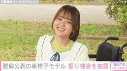 「20歳まで生きられない病気って言われてた」難病公表の車椅子モデル・玉置陽葵（19）、振り袖姿を披露