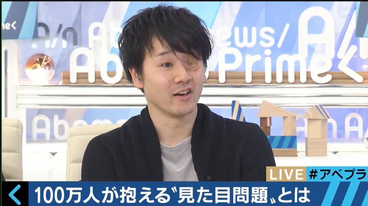 実は100万人が抱える“見た目問題” 当事者たちの生きづらさとは